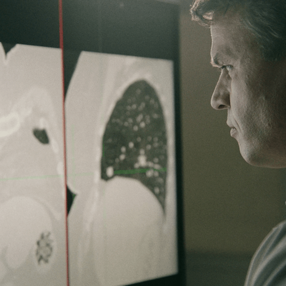 Surgeon viewing MRI scans